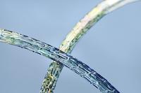 Small Vessel BIOFLOW-II Subgroup Analyses Demonstrate Top Performance of BIOTRONIK Orsiro